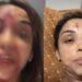 Ex-companheiro da cantora Walkiria Estarley é preso após denúncia de agressão