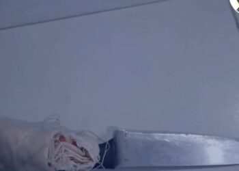 Homem é preso após atacar ex-companheira e esfaquear vítima que tentou defendê-la em Imperatriz